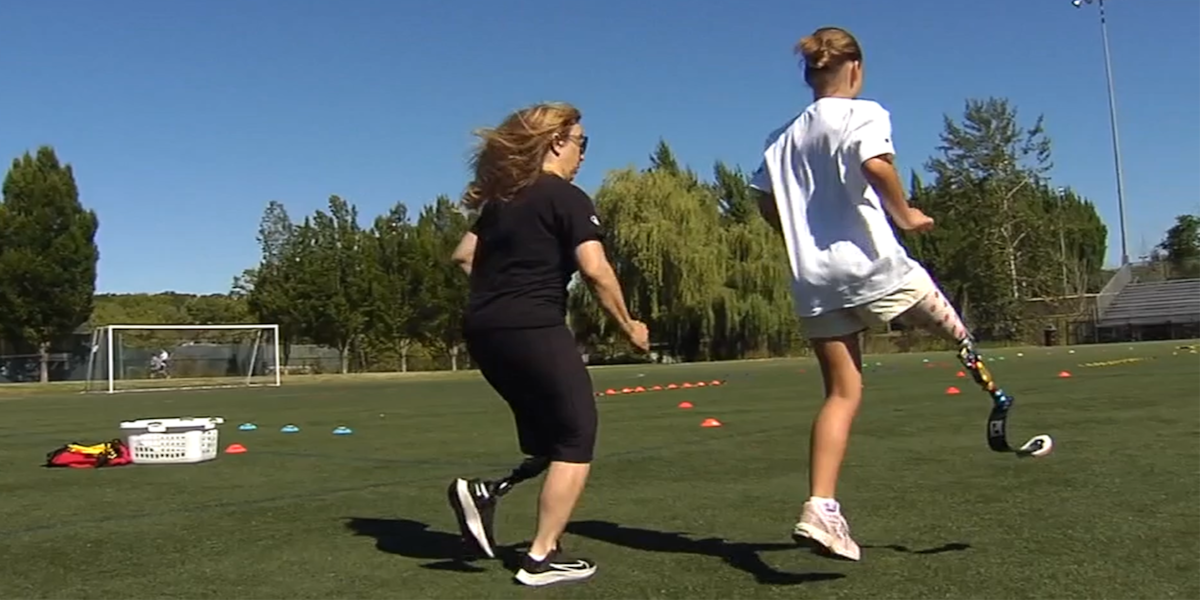 Springblade Prosthetic Young athletes get new free running blade prosthetics at Beaverton event