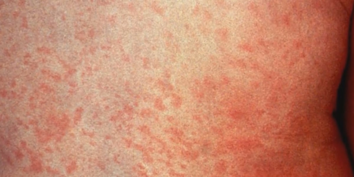 K4APK3YODBARJPFZCRQJIYUEYA.png?auth=5859