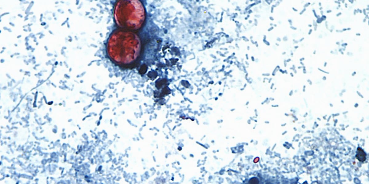 Oregon reports 2 Cyclospora cases tied to lettuce recall - KPTV