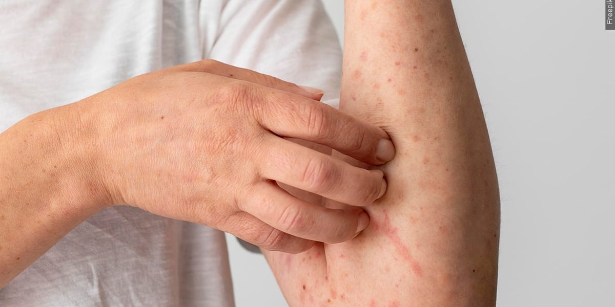 3 Providence locations identified as measles exposure sites in Multnomah, Clackamas counties - KPTV