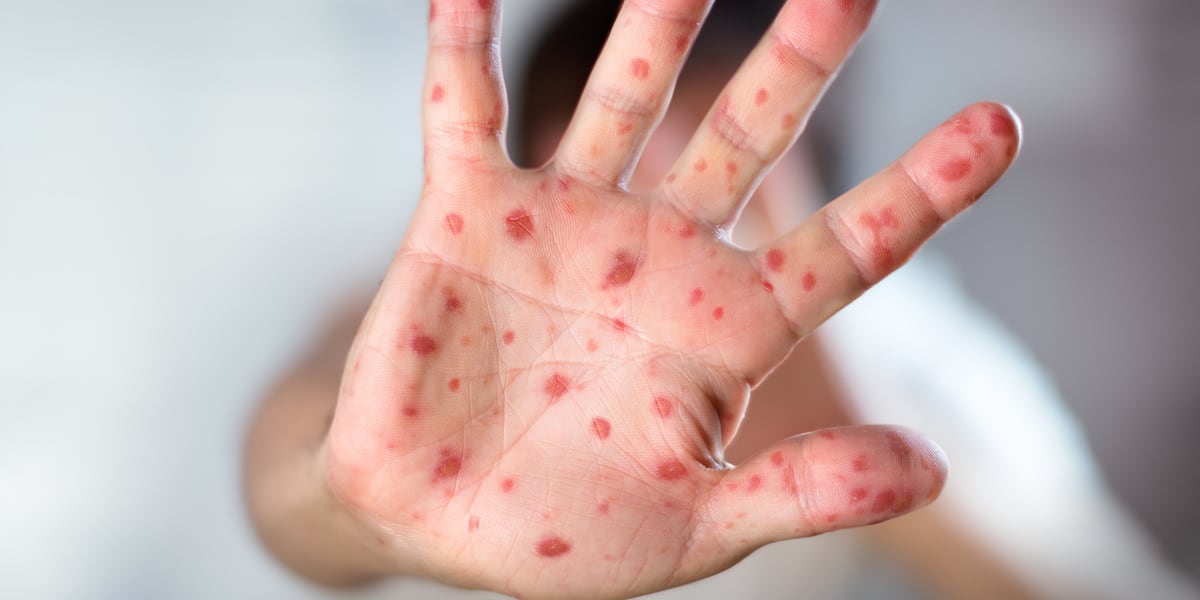 ZAV35UWAOJDVRFGJIJLOCABS44.jpeg?auth=26c